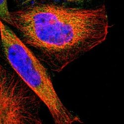 Invitrogen TSC22D4 Polyclonal Antibody 100 &mu;L | Buy Online | Invitrogen&trade; | Fisher Scientific