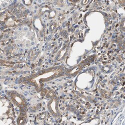 Invitrogen TSC22D4 Polyclonal Antibody 100 &mu;L | Buy Online | Invitrogen&trade; | Fisher Scientific