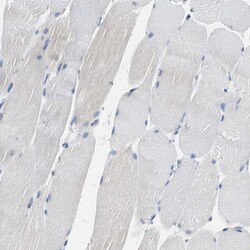 Invitrogen TSC22D4 Polyclonal Antibody 100 &mu;L | Buy Online | Invitrogen&trade; | Fisher Scientific
