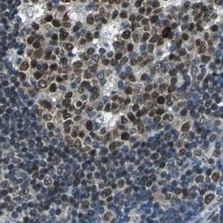 Invitrogen USP28 Polyclonal Antibody 100 &mu;L | Buy Online | Invitrogen&trade; | Fisher Scientific