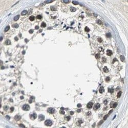 Invitrogen USP28 Polyclonal Antibody 100 &mu;L | Buy Online | Invitrogen&trade; | Fisher Scientific