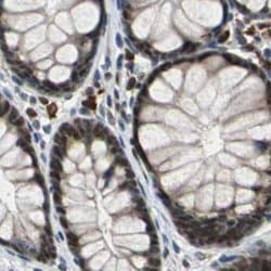 Invitrogen USP28 Polyclonal Antibody 100 &mu;L | Buy Online | Invitrogen&trade; | Fisher Scientific