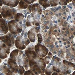 Invitrogen USP28 Polyclonal Antibody 100 &mu;L | Buy Online | Invitrogen&trade; | Fisher Scientific