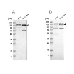 Invitrogen USP28 Polyclonal Antibody 100 &mu;L | Buy Online | Invitrogen&trade; | Fisher Scientific