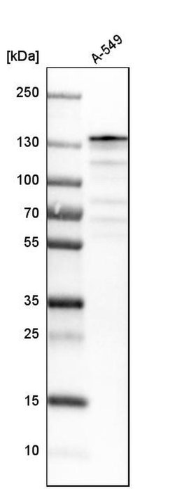 Invitrogen USP28 Polyclonal Antibody 100 &mu;L | Buy Online | Invitrogen&trade; | Fisher Scientific