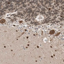 Invitrogen DRAP1 Polyclonal Antibody 100 &mu;L; Unconjugated:Antibodies,