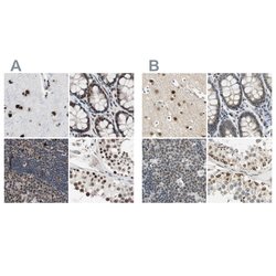 Invitrogen POGZ Polyclonal Antibody 100 &mu;L; Unconjugated:Antibodies,