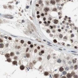 Invitrogen POGZ Polyclonal Antibody 100 &mu;L; Unconjugated:Antibodies,