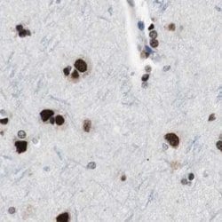 Invitrogen POGZ Polyclonal Antibody 100 &mu;L; Unconjugated:Antibodies,