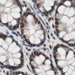 Invitrogen POGZ Polyclonal Antibody 100 &mu;L; Unconjugated:Antibodies,