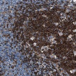 Invitrogen SWAP70 Polyclonal Antibody 100 &mu;L; Unconjugated:Antibodies,
