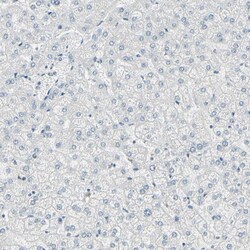 ThPOK Polyclonal Antibody:Antibodies, Polyclonal