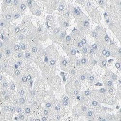 ThPOK Polyclonal Antibody:Antibodies, Polyclonal