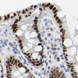 ThPOK Polyclonal Antibody:Antibodies, Polyclonal