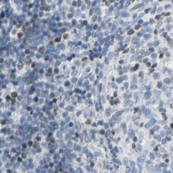 ThPOK Polyclonal Antibody:Antibodies, Polyclonal