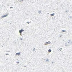 ThPOK Polyclonal Antibody:Antibodies, Polyclonal
