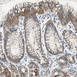 Invitrogen NKAIN1 Polyclonal Antibody 100 &mu;L; Unconjugated:Antibodies,