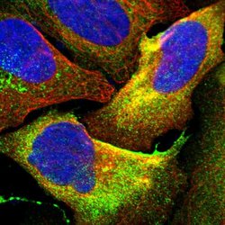 Invitrogen HAI-1 Polyclonal Antibody 100 &mu;L; Unconjugated:Antibodies,