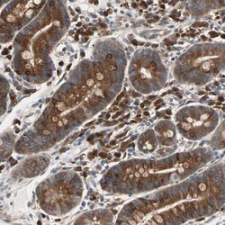 SAR1A Polyclonal Antibody:Antibodies, Polyclonal