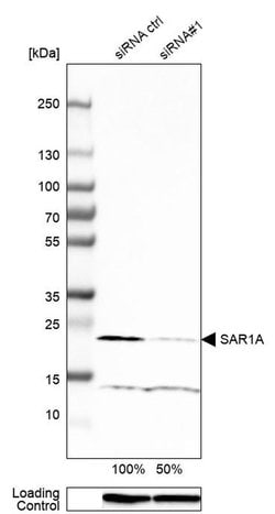 SAR1A Polyclonal Antibody:Antibodies, Polyclonal