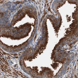 Invitrogen LITAF Polyclonal Antibody 100 &mu;L; Unconjugated:Antibodies,