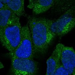 Invitrogen ZNF135 Polyclonal Antibody 100 &mu;L; Unconjugated:Antibodies,