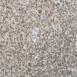 Invitrogen ZNF135 Polyclonal Antibody 100 &mu;L; Unconjugated:Antibodies,