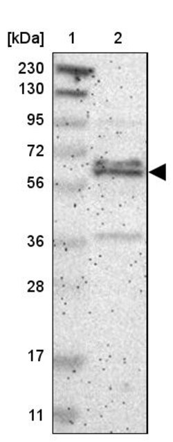 Invitrogen ZNF135 Polyclonal Antibody 100 &mu;L; Unconjugated:Antibodies,
