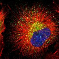 Invitrogen RAB7 Polyclonal Antibody 100 &mu;L; Unconjugated:Antibodies,