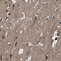 Invitrogen RAB7 Polyclonal Antibody 100 &mu;L; Unconjugated:Antibodies,