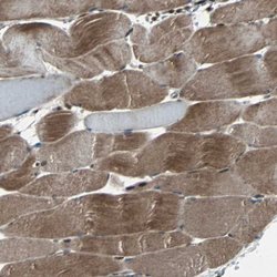 Invitrogen RAB7 Polyclonal Antibody 100 &mu;L; Unconjugated:Antibodies,