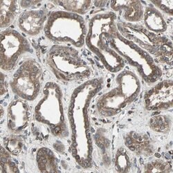 Invitrogen RAB7 Polyclonal Antibody 100 &mu;L; Unconjugated:Antibodies,