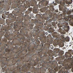 Invitrogen RAB7 Polyclonal Antibody 100 &mu;L; Unconjugated:Antibodies,