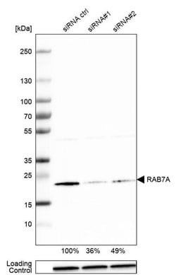 Invitrogen RAB7 Polyclonal Antibody 100 &mu;L; Unconjugated:Antibodies,
