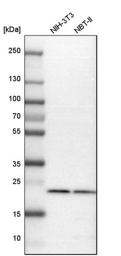 Invitrogen RAB7 Polyclonal Antibody 100 &mu;L; Unconjugated:Antibodies,