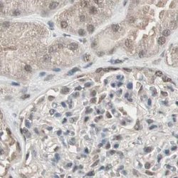 Invitrogen ZHX2 Polyclonal Antibody 100 &mu;L | Buy Online | Invitrogen&trade; | Fisher Scientific