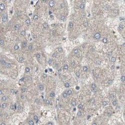 Invitrogen ZHX2 Polyclonal Antibody 100 &mu;L | Buy Online | Invitrogen&trade; | Fisher Scientific