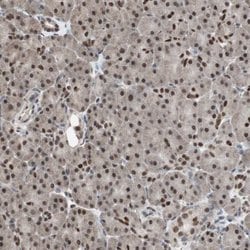 Invitrogen ZHX2 Polyclonal Antibody 100 &mu;L | Buy Online | Invitrogen&trade; | Fisher Scientific