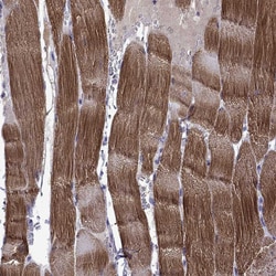 Invitrogen Titin Polyclonal Antibody 100 &mu;L; Unconjugated:Antibodies,