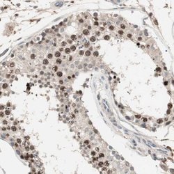 Invitrogen NFRKB Polyclonal Antibody 100 &mu;L | Buy Online | Invitrogen&trade; | Fisher Scientific