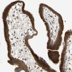 Invitrogen GALK1 Polyclonal Antibody 100 &mu;L; Unconjugated:Antibodies,