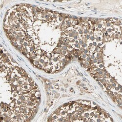 Invitrogen GALK1 Polyclonal Antibody 100 &mu;L; Unconjugated:Antibodies,