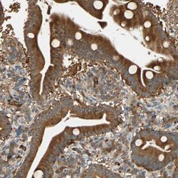 Invitrogen GALK1 Polyclonal Antibody 100 &mu;L; Unconjugated:Antibodies,