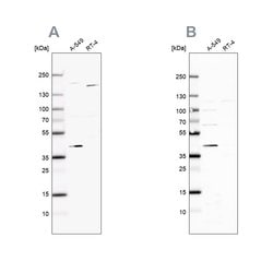Invitrogen GALK1 Polyclonal Antibody 100 &mu;L; Unconjugated:Antibodies,
