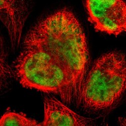 Invitrogen ZNF323 Polyclonal Antibody 100 &mu;L; Unconjugated:Antibodies,