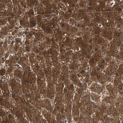 Invitrogen ZNF323 Polyclonal Antibody 100 &mu;L; Unconjugated:Antibodies,