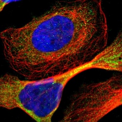 Invitrogen ADNP2 Polyclonal Antibody 100 &mu;L; Unconjugated:Antibodies,