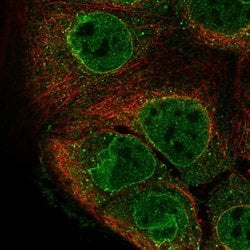 Invitrogen GPR114 Polyclonal Antibody 100 &mu;L; Unconjugated:Antibodies,
