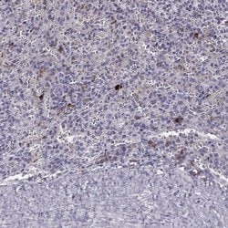 Invitrogen GPR114 Polyclonal Antibody 100 &mu;L; Unconjugated:Antibodies,