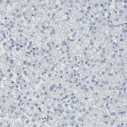 Invitrogen DMPK Polyclonal Antibody 100 &mu;L | Buy Online | Invitrogen&trade; | Fisher Scientific